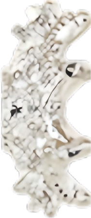 Platinum Bead Cap No. 1 — Right 10mm