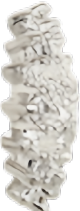 Silver Bead Cap — Left 13mm